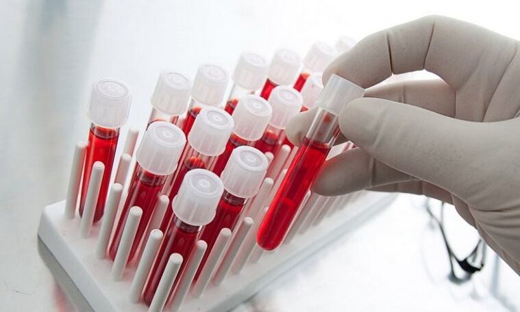 sangue em tubos de ensaio para análise de um cão com prostatite