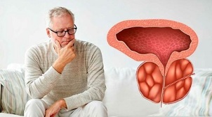 causas de prostatite bacteriana em homens